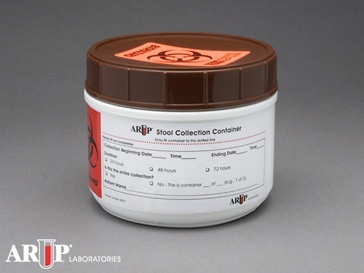 Fat, Fecal Quantitative, Homogenized Aliquot | ARUP Laboratories Test  Directory